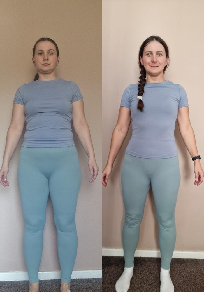 Client before and after, standing front-on
